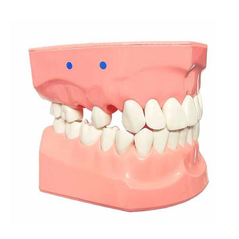 [Atria] Dental Model (환자 설명용 모델)
