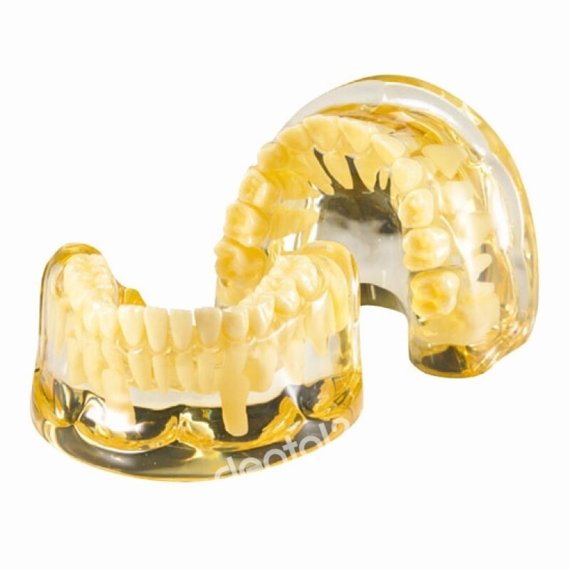 [한일] 치아교체 설명 덴티폼 다이아몬드 HL-60020