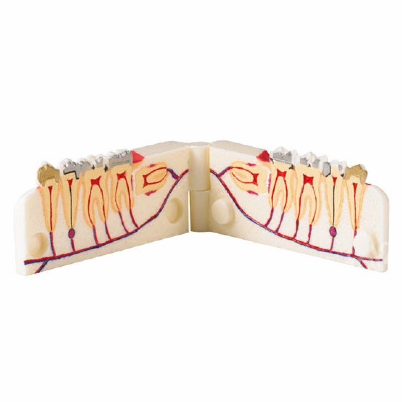 [한일] 치아수복 모델 (V-Type)  HL-60037